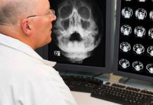 PACS radiography