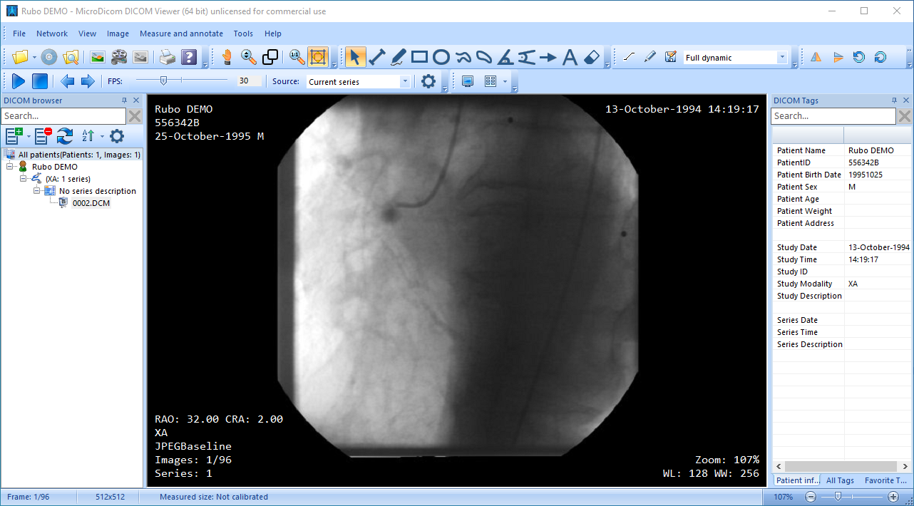 free DICOM viewer online