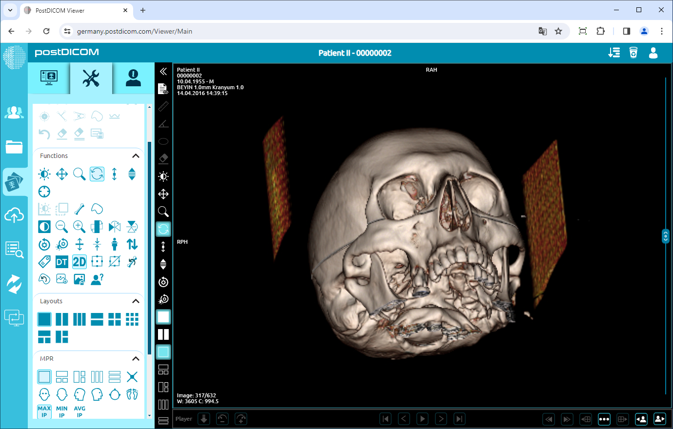 free online DICOM viewer