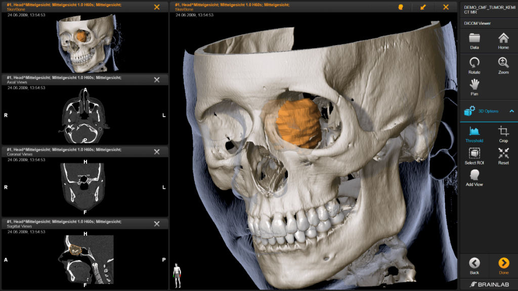 free online DICOM viewer